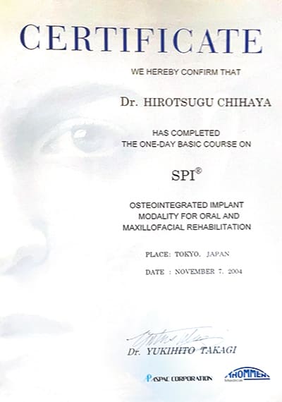 SPIインプラント