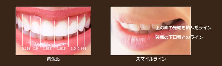 黄金比とスマイルライン