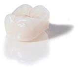 審美歯科の保証