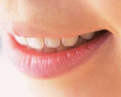 美しい仕上がりの審美インプラント治療