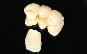 作製した使用するブリッジ