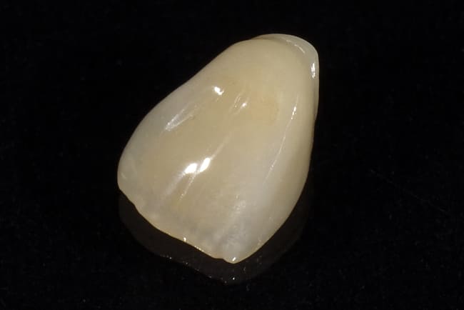 審美歯科の匠のこだわり