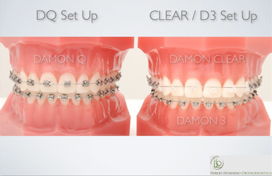 デーモンシステム