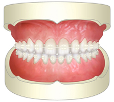 目立たないデーモンシステム